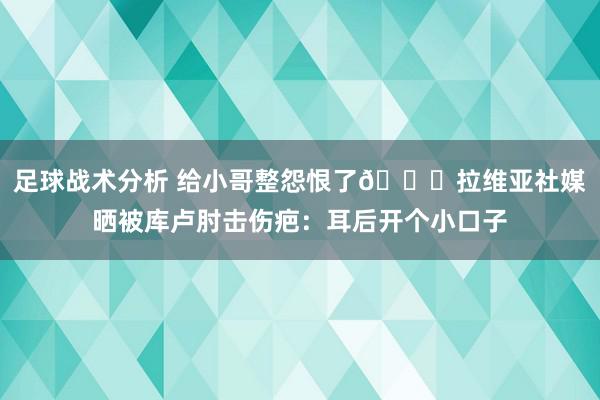 足球战术分析 给小哥整怨恨了😅拉维亚社媒晒被库卢肘击伤疤：耳后开个小口子